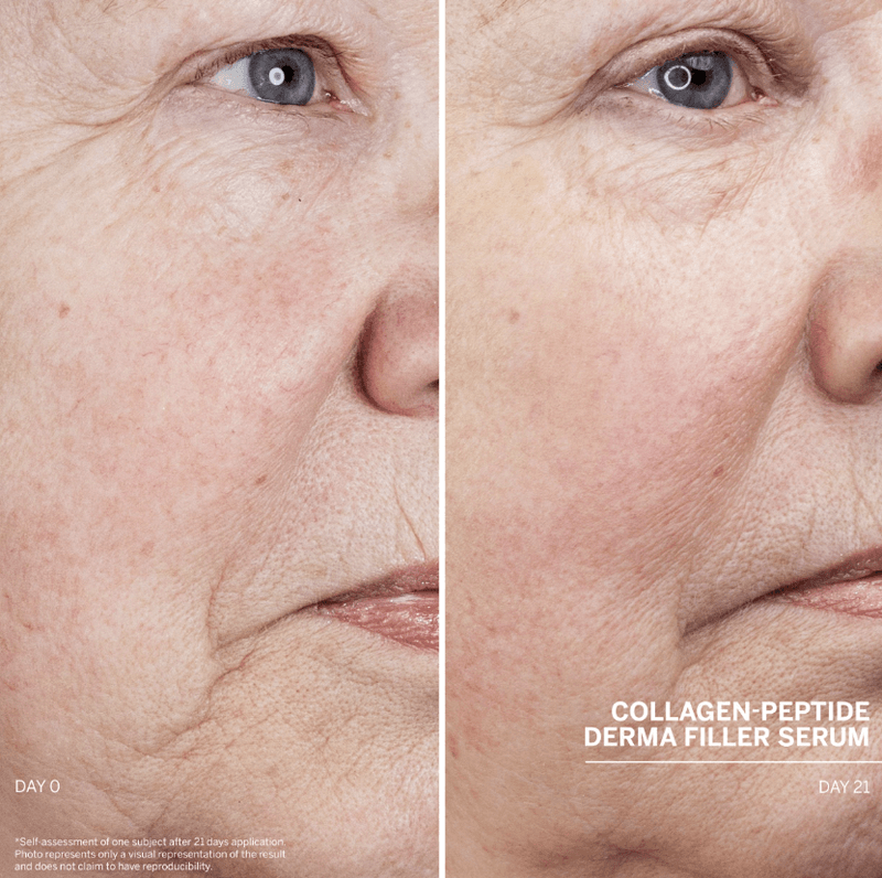 Doctor Babor Lifting Derma Filler Serum 